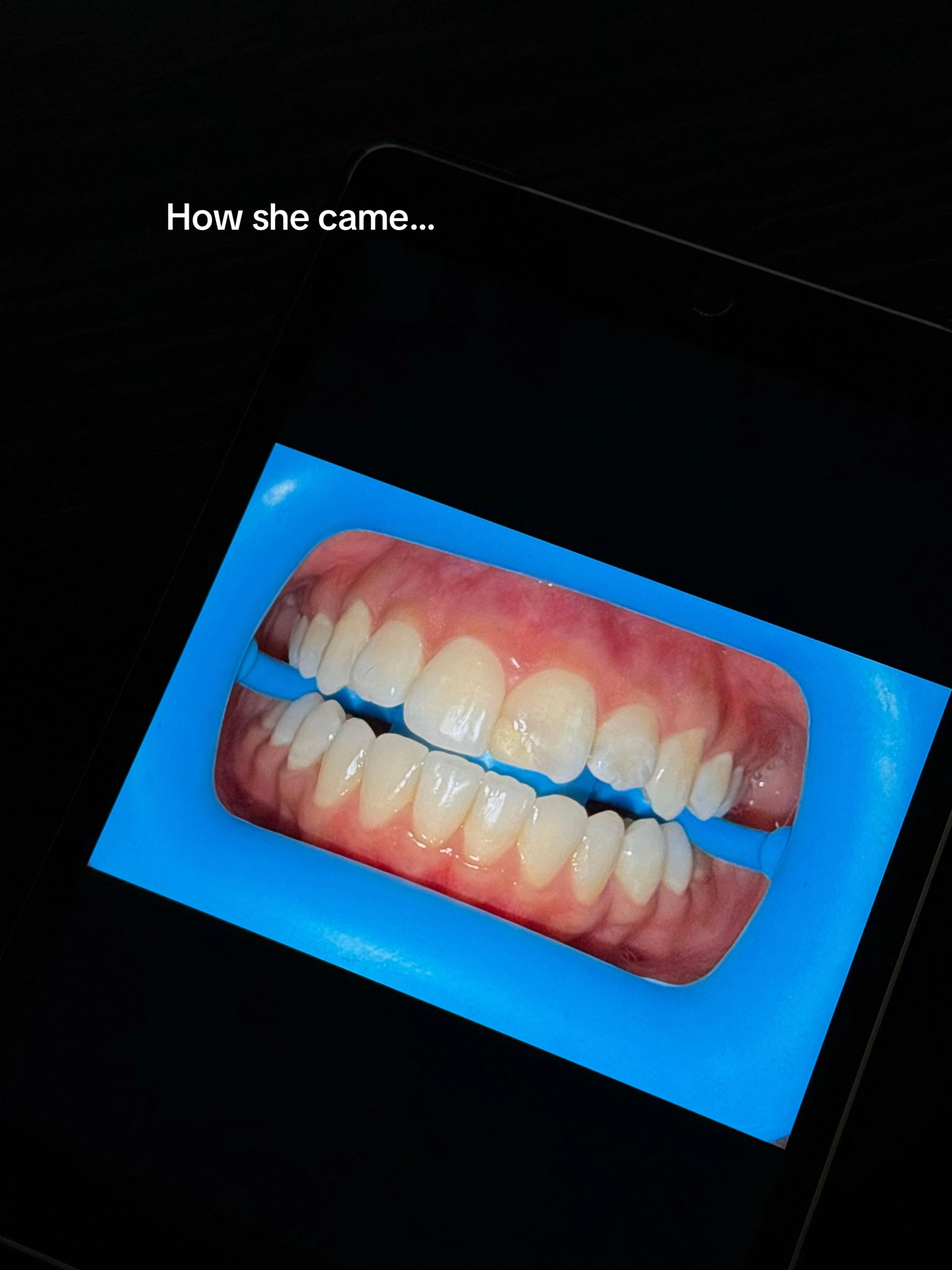 @Halal Teeth Whitening London