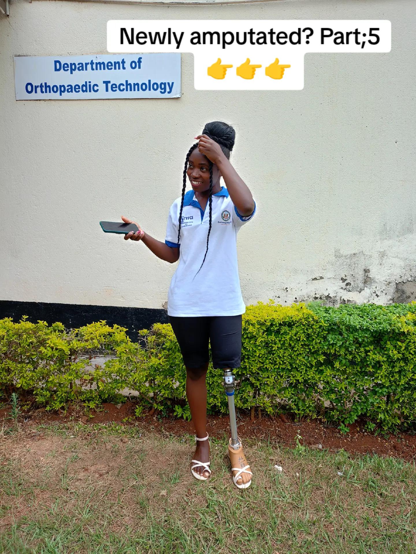 @Amputee girl