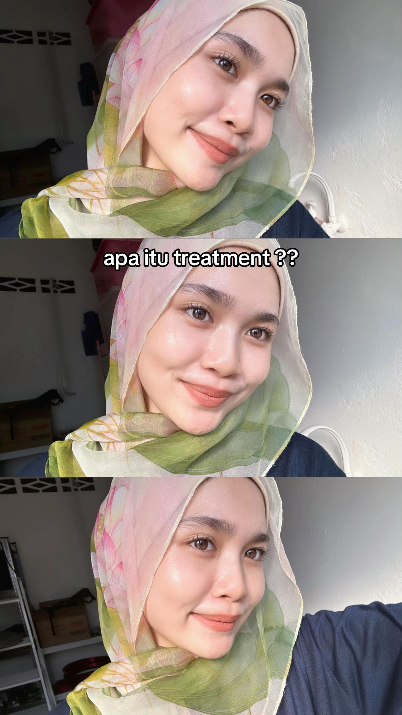 @iraa