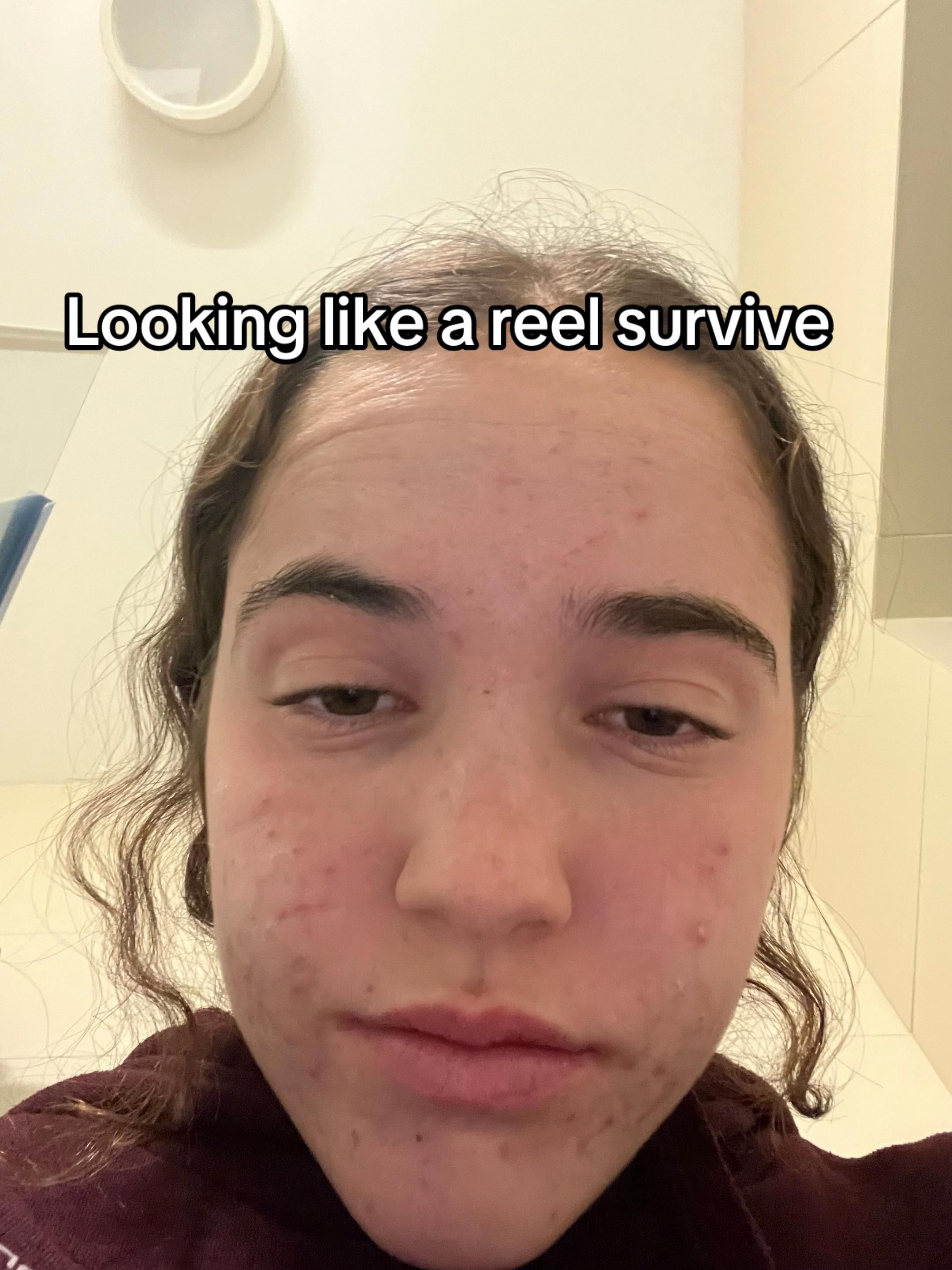 @אלמוג