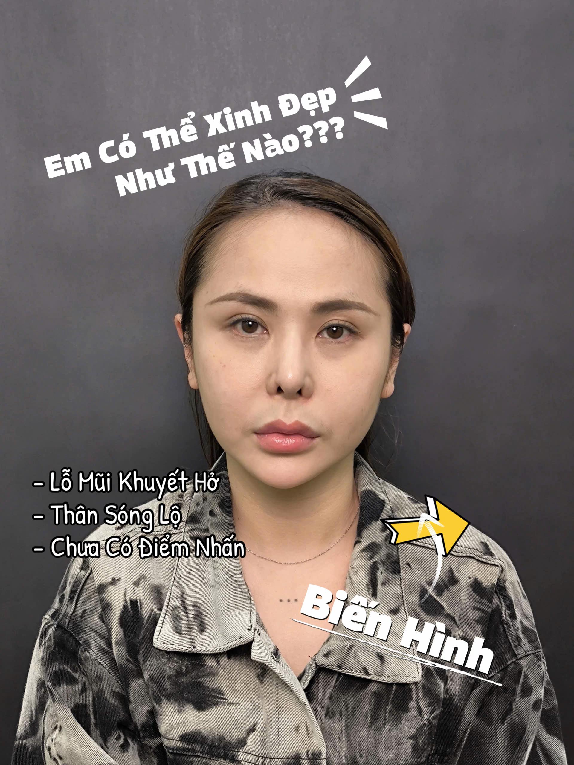 @Bs Nguyễn Tiến Huy