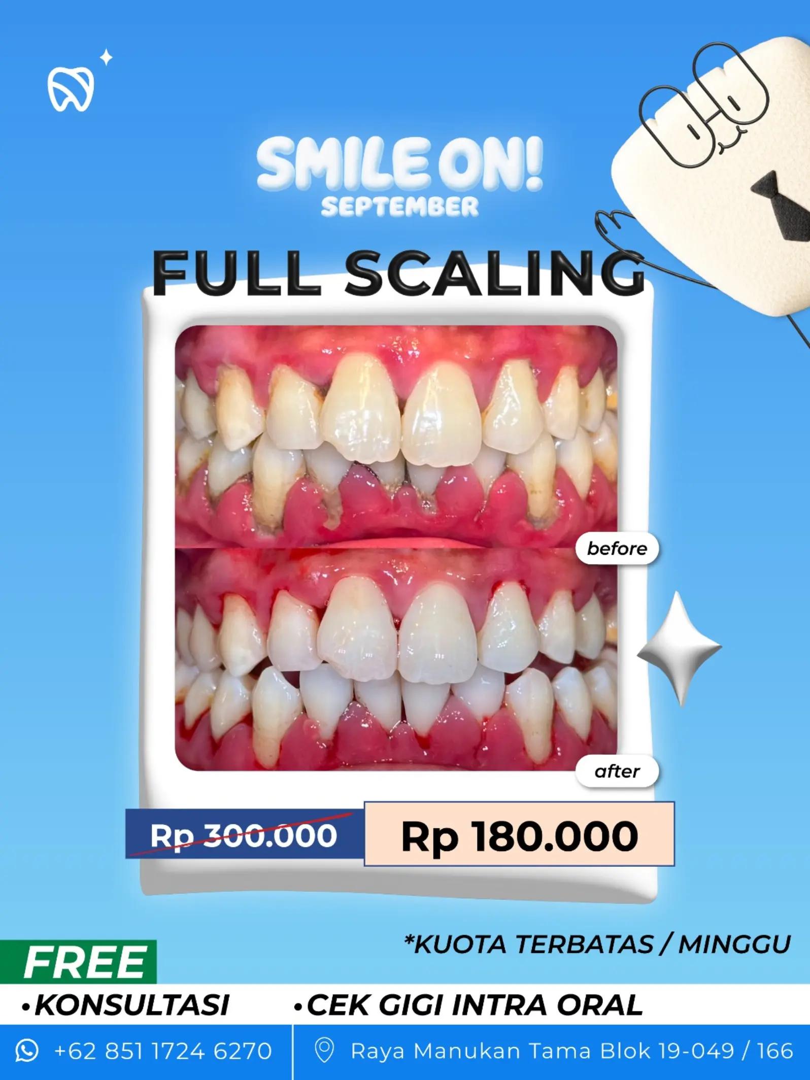 @Dentine Plus