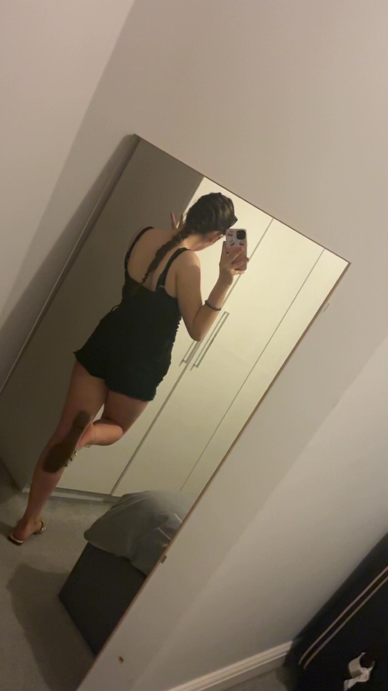 @𝐬𝐜𝐚𝐫🍒🫶🏽