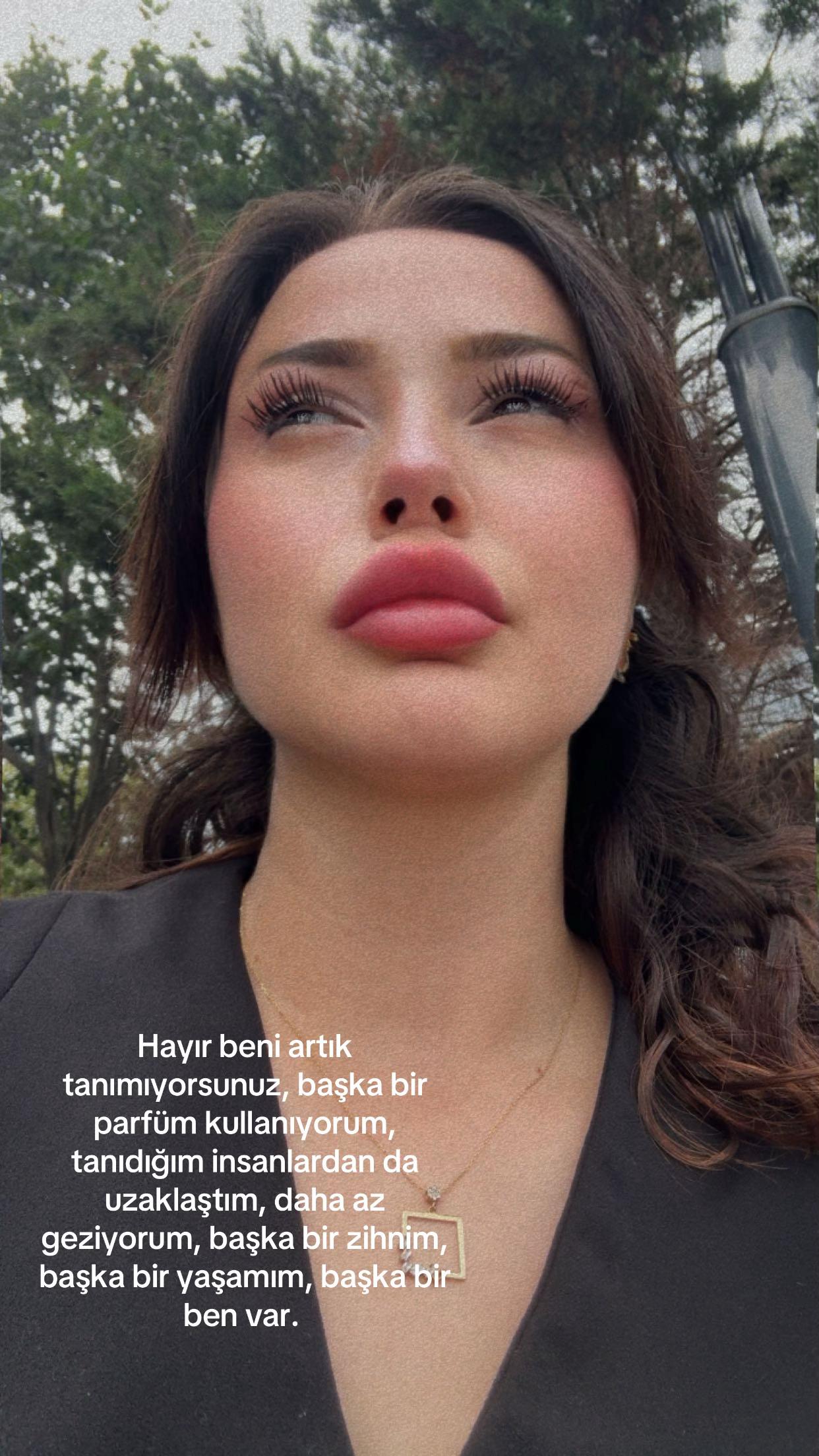 @Duygu Ak