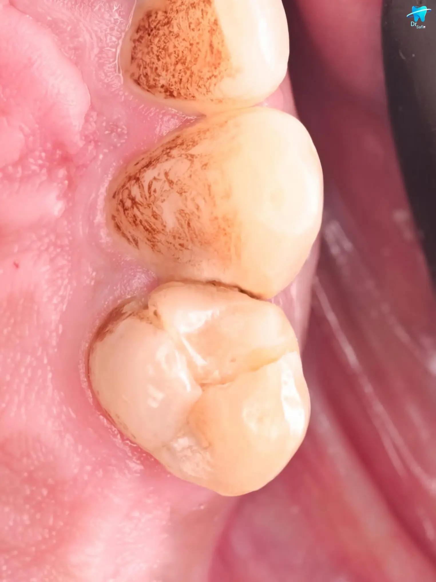@Dentist 🦷