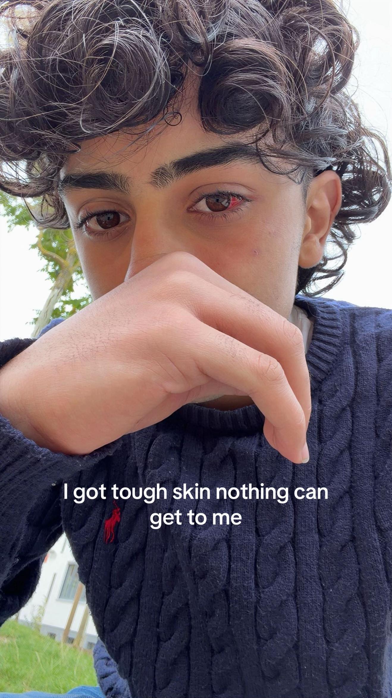 @ 