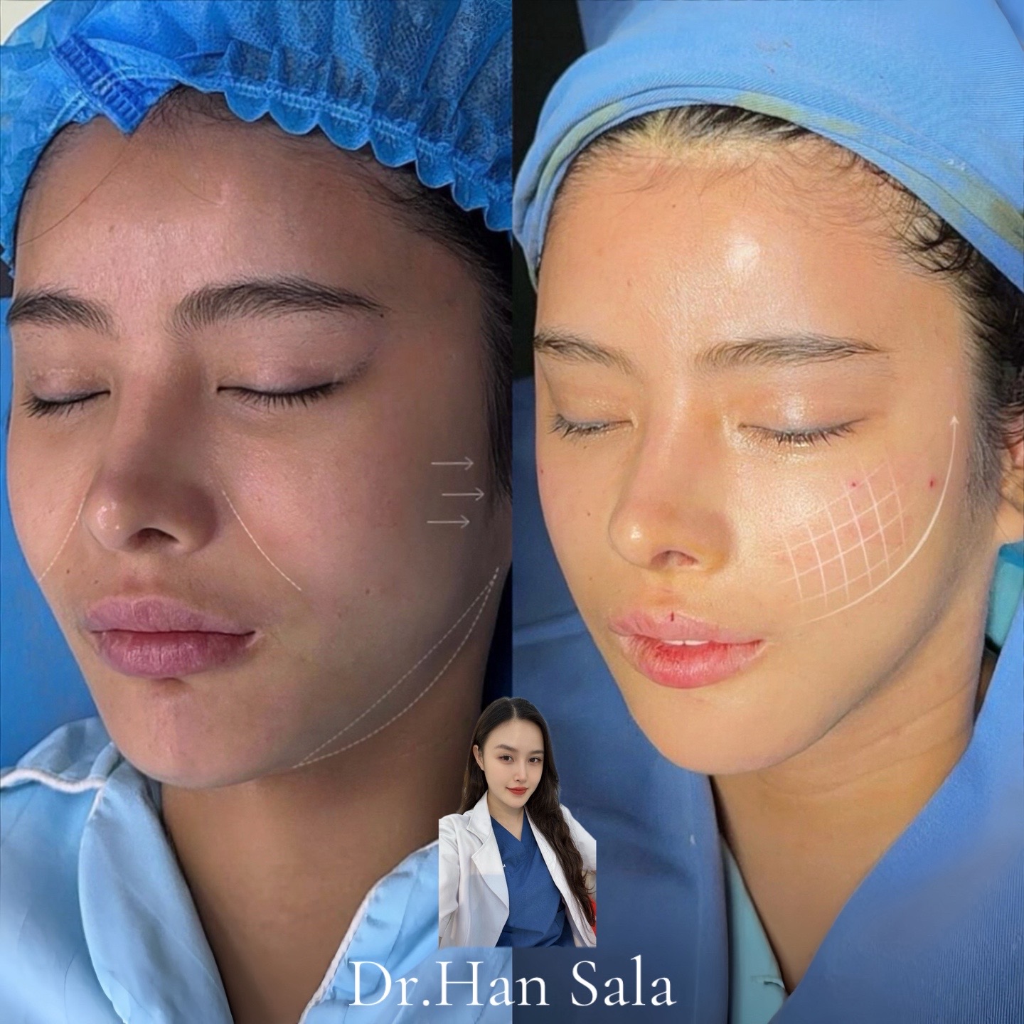 @Dr.Han Sala Beauty