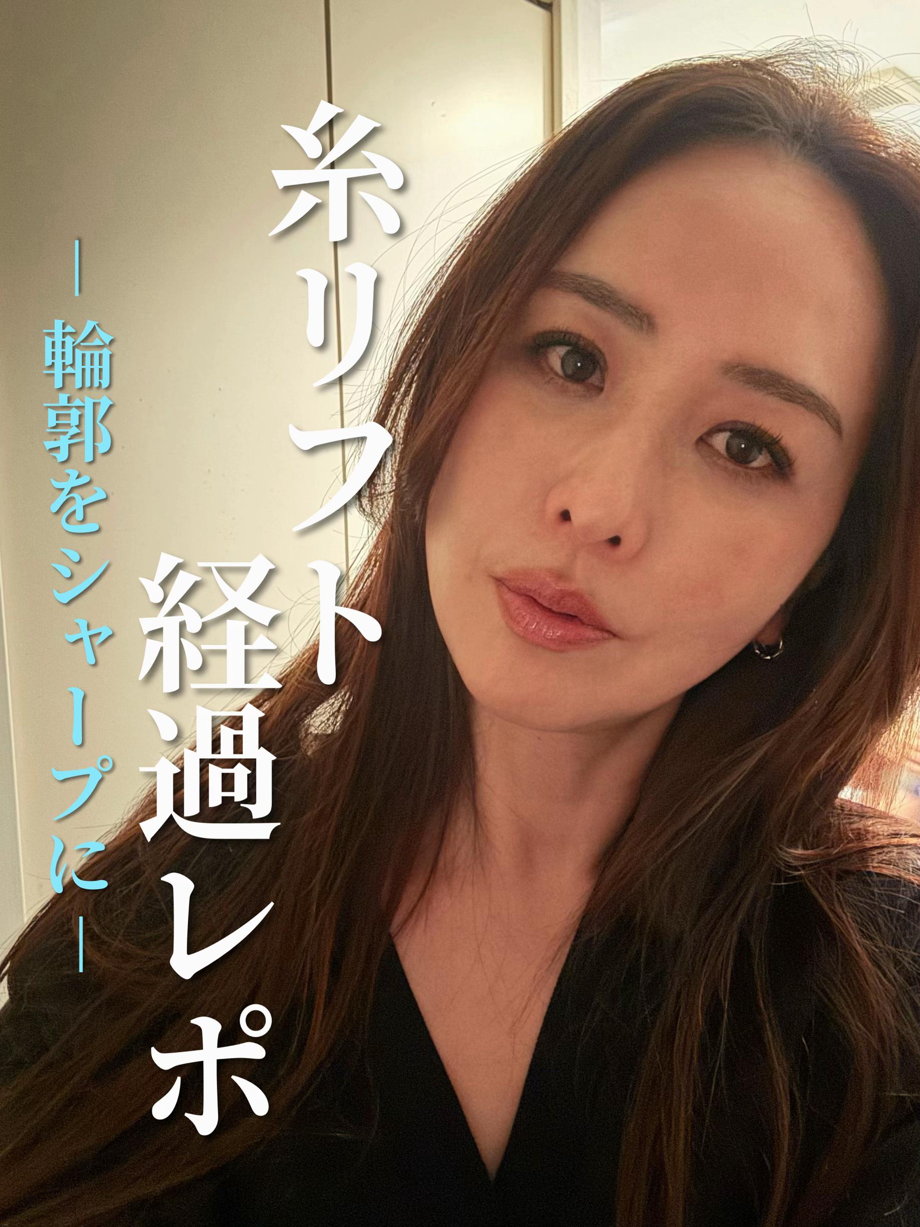 @金澤紀臣【小顔/若返り/脂肪吸引】