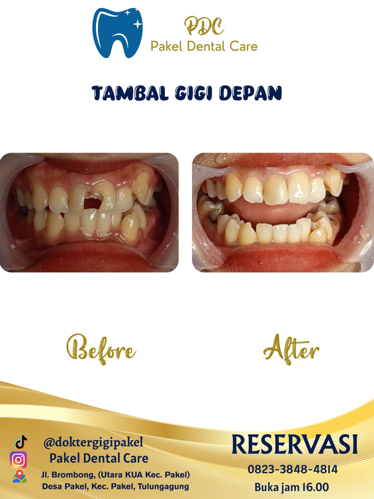 @Pakeldentalcare