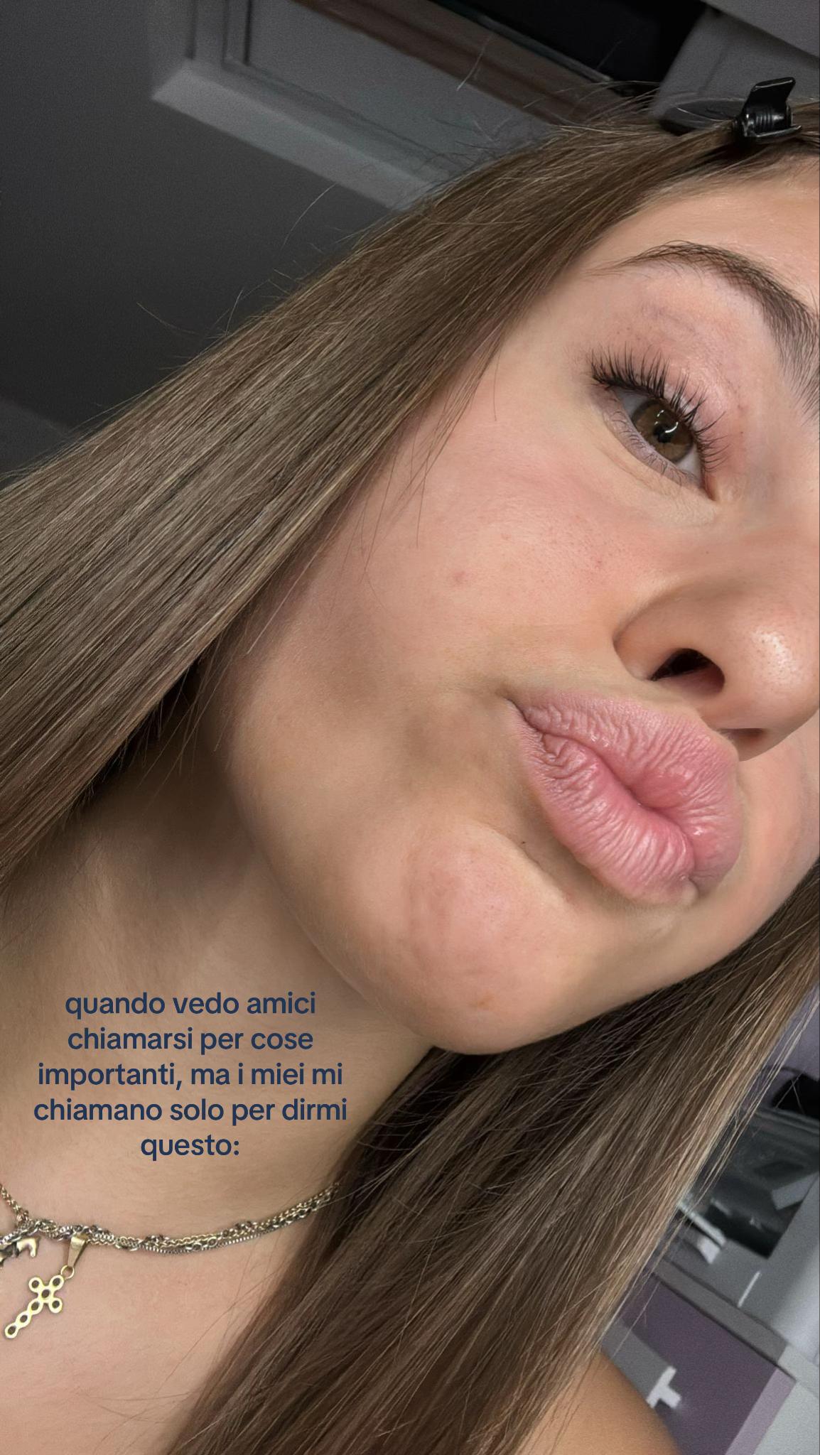 @Elisa Bonacina