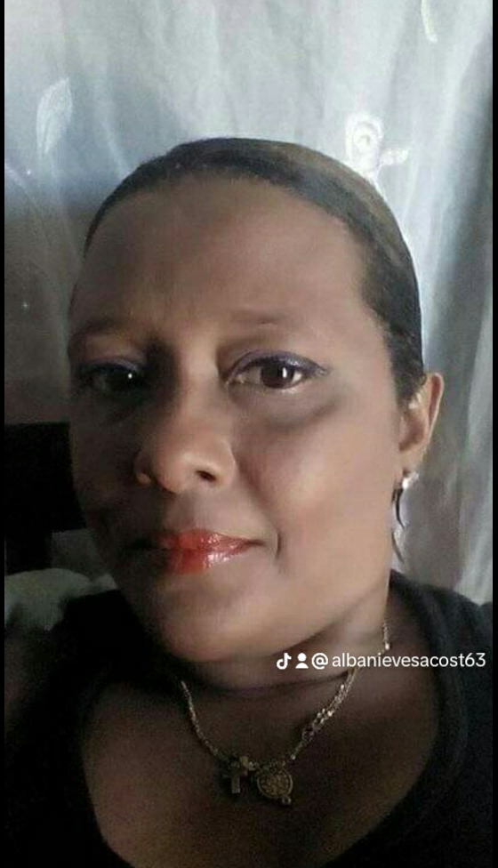 @Alba Nieves Acosta Muñoz