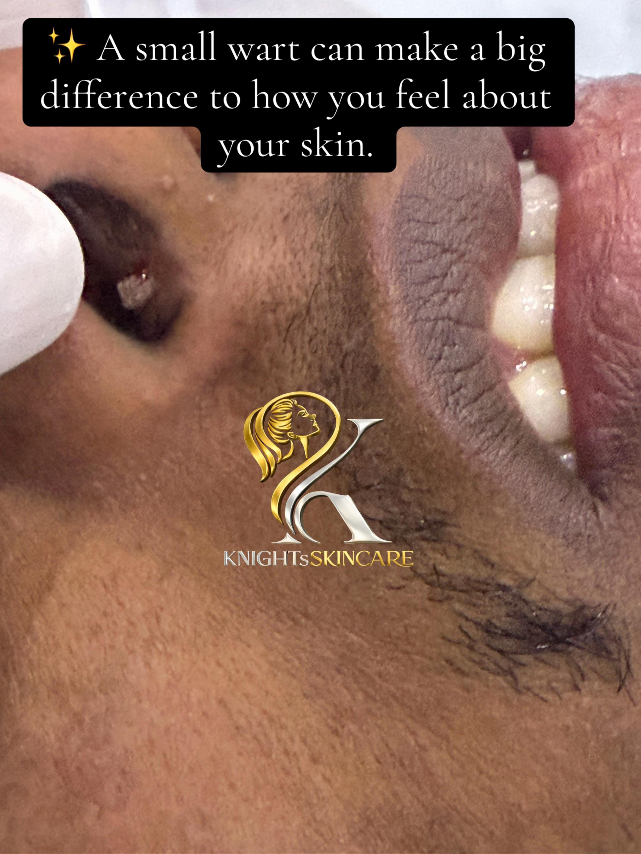 @KNIGHTS | SKINCARE | KENYA