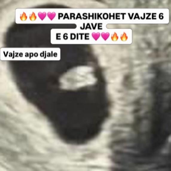 @Vajze apo Djale? 💙💖