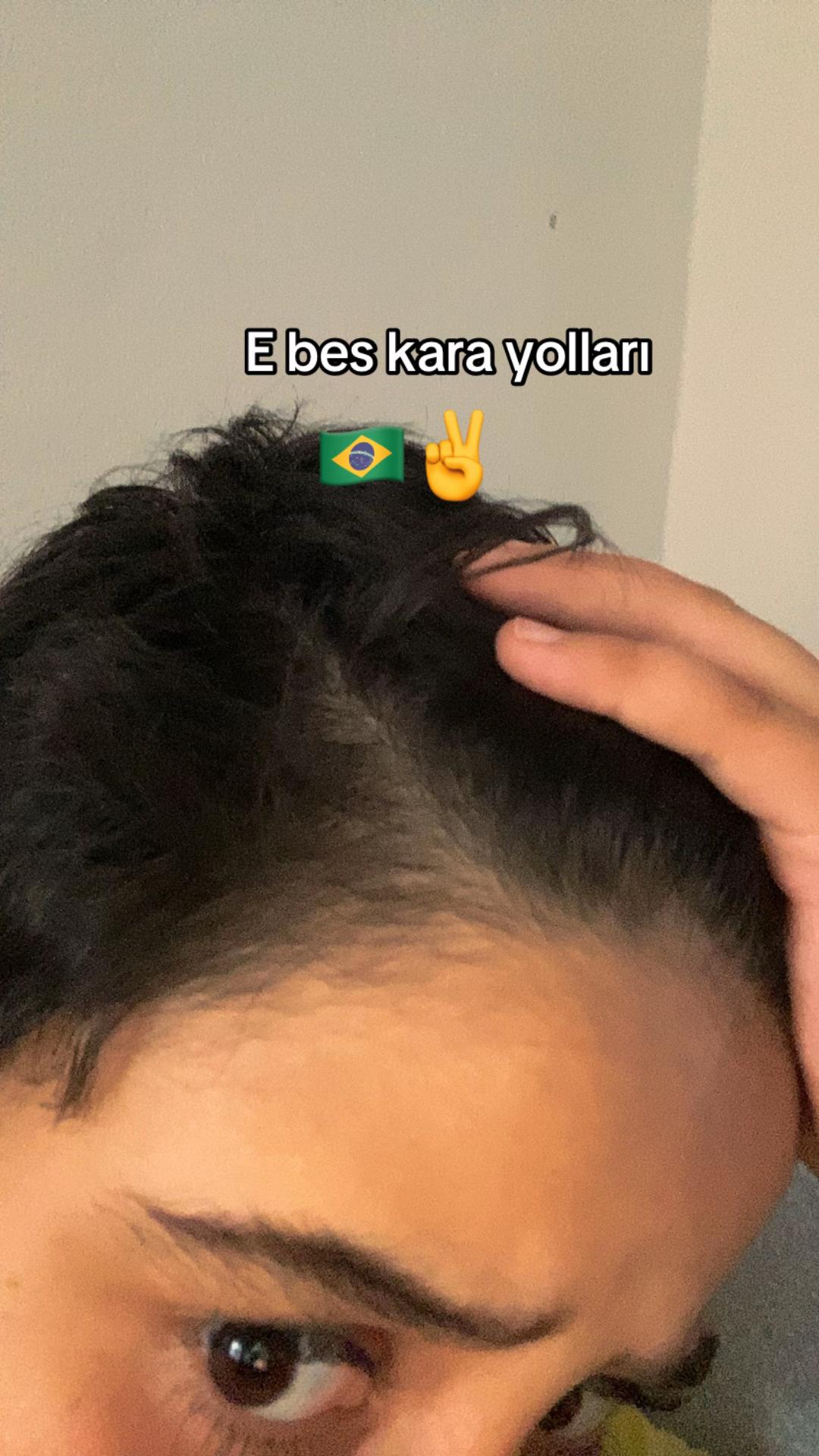 @Anıl🇹🇷