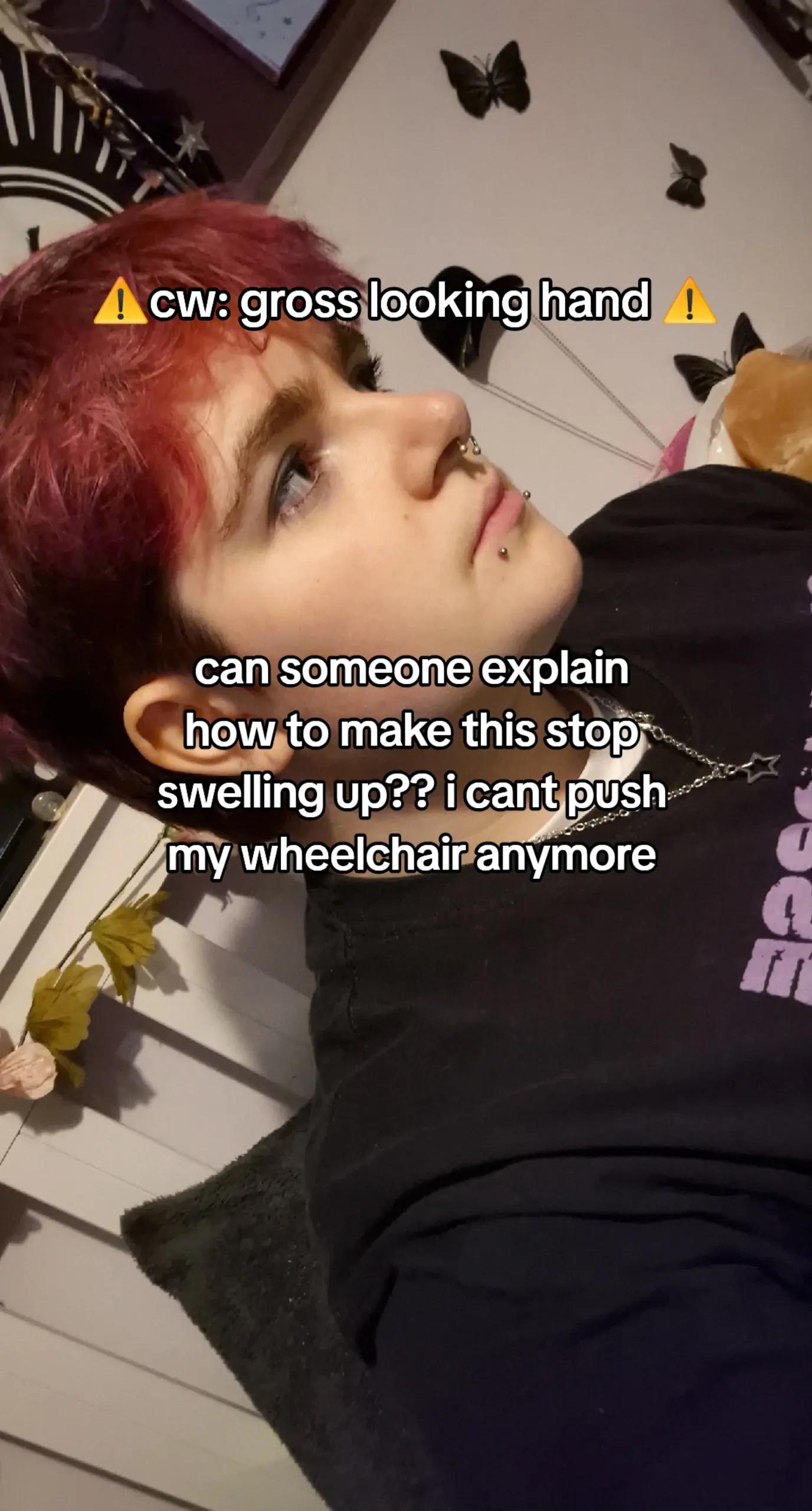 @noa