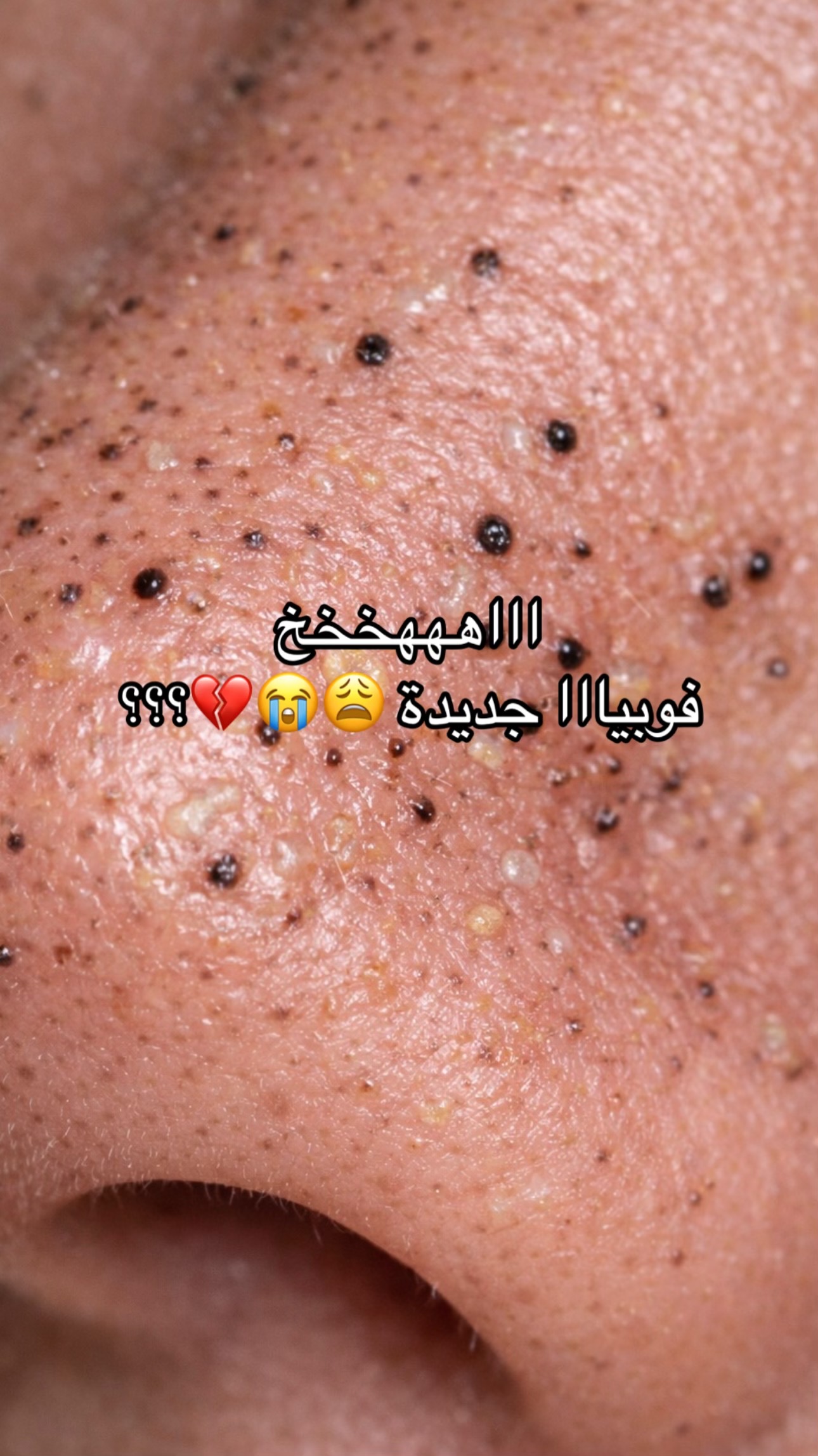 @شيماء الحربي🍒