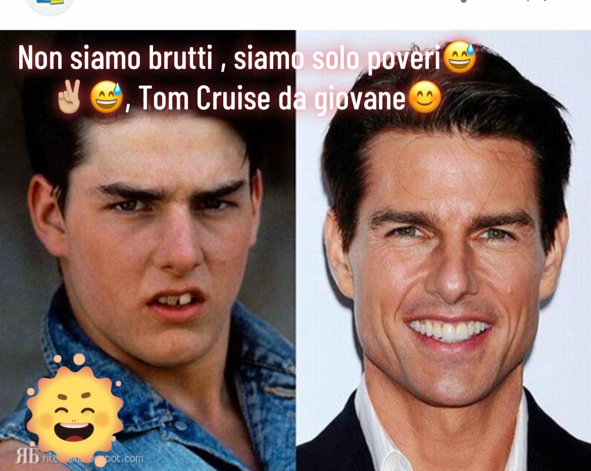 @giovio1