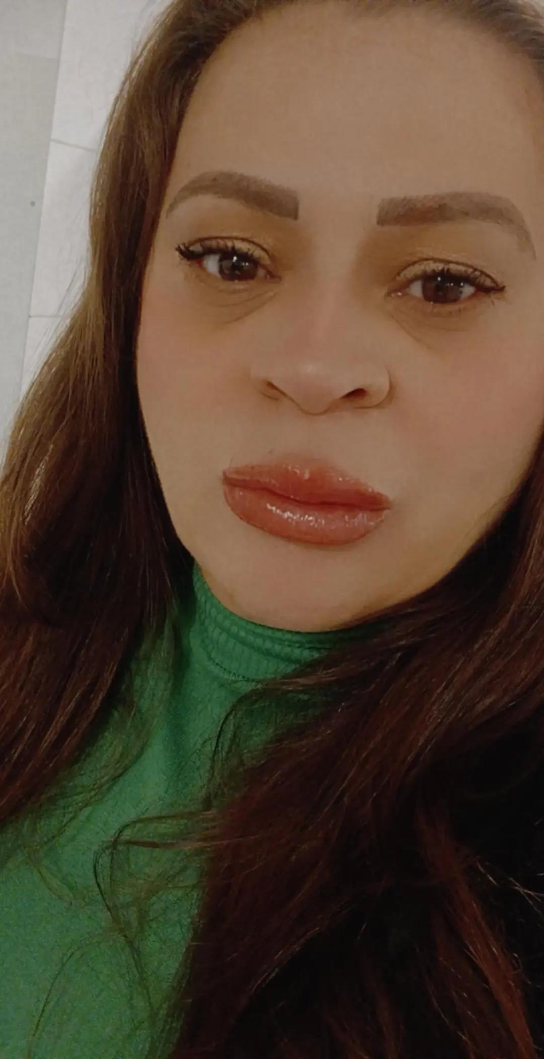 @Dany Assis