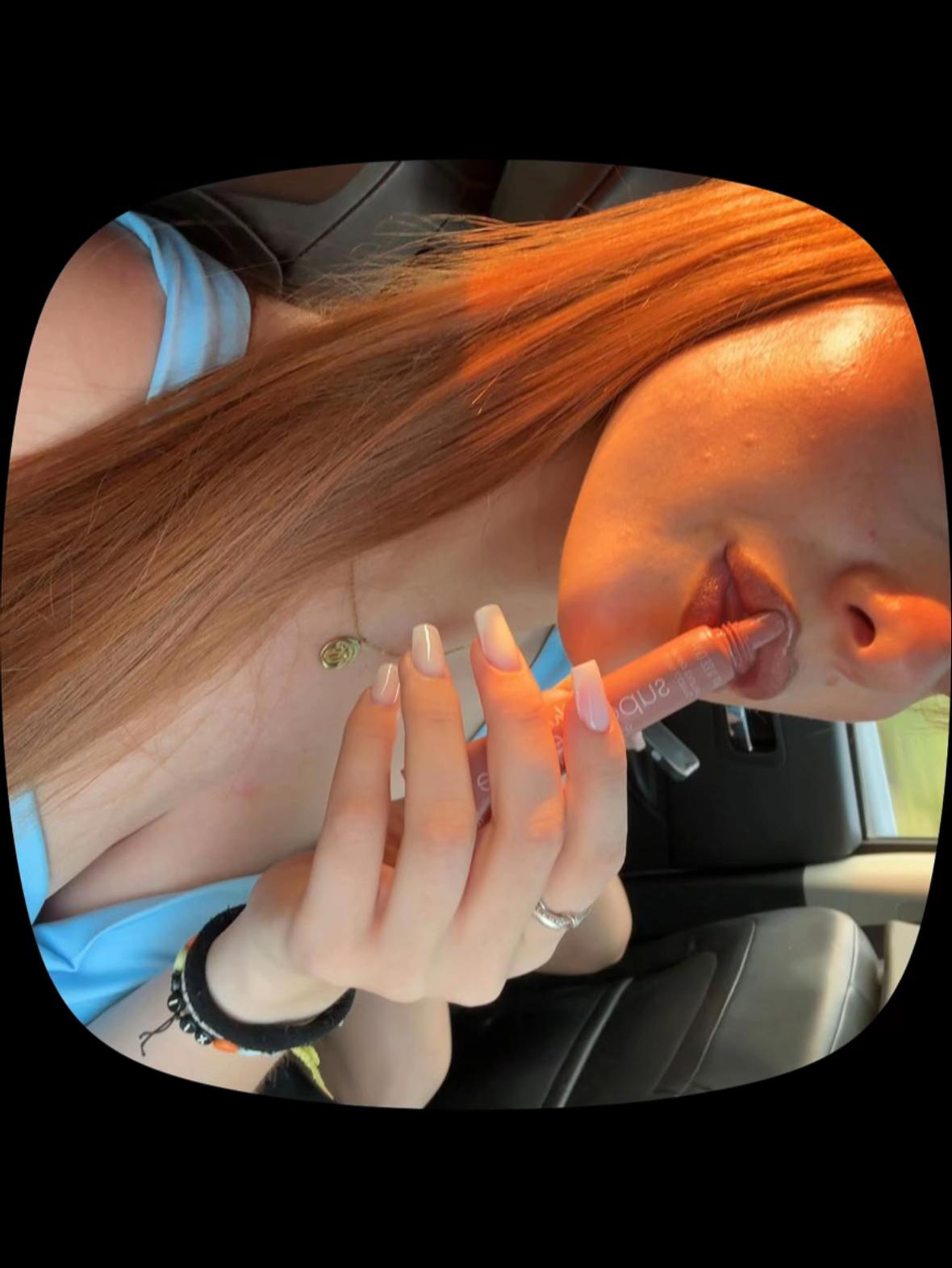 @rossaa🦊