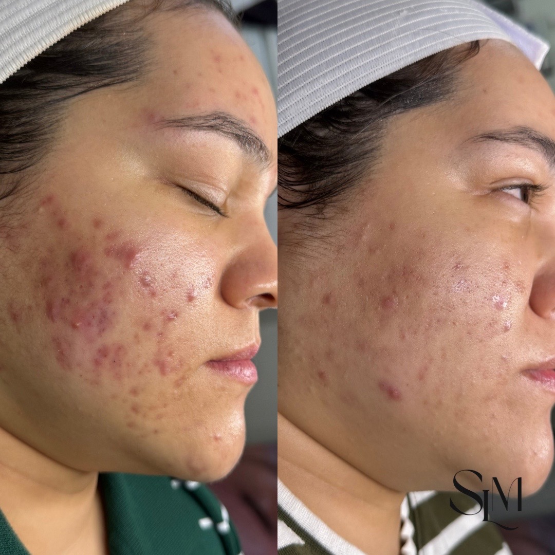 @Myrah | Midland Aesthetician