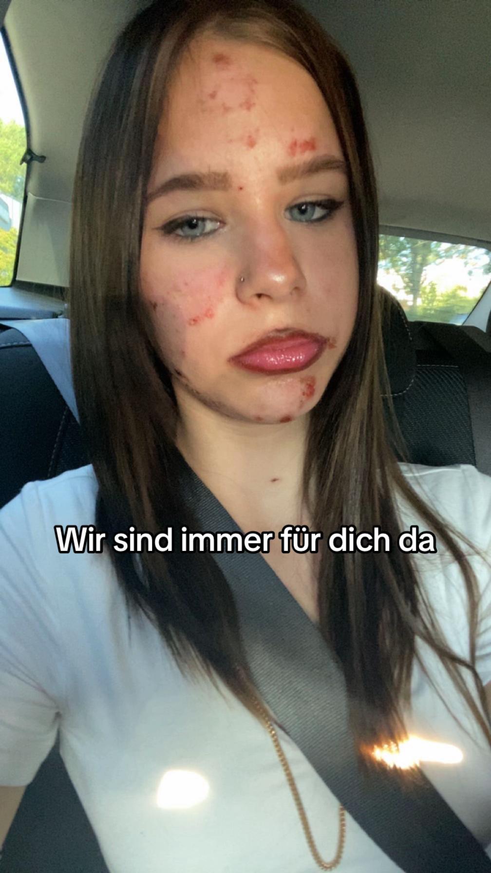 @Elisa