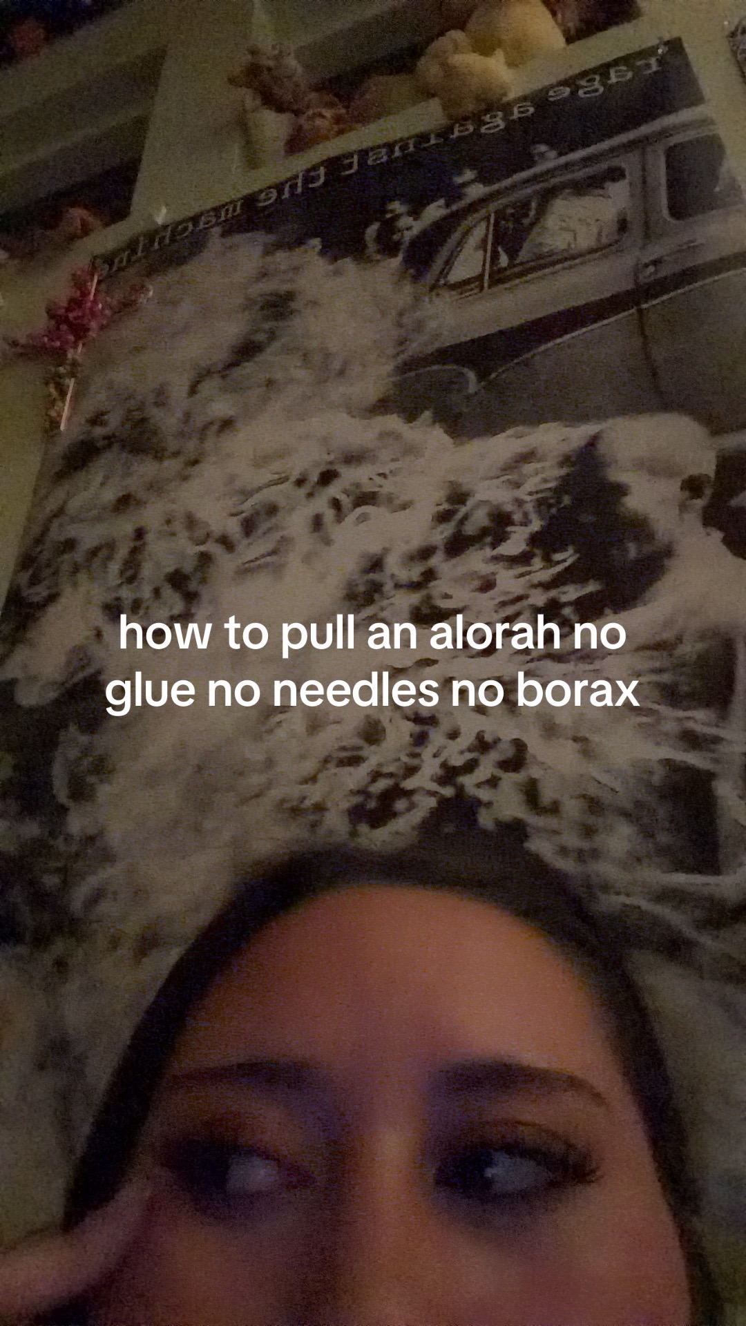 @Haipatitis B