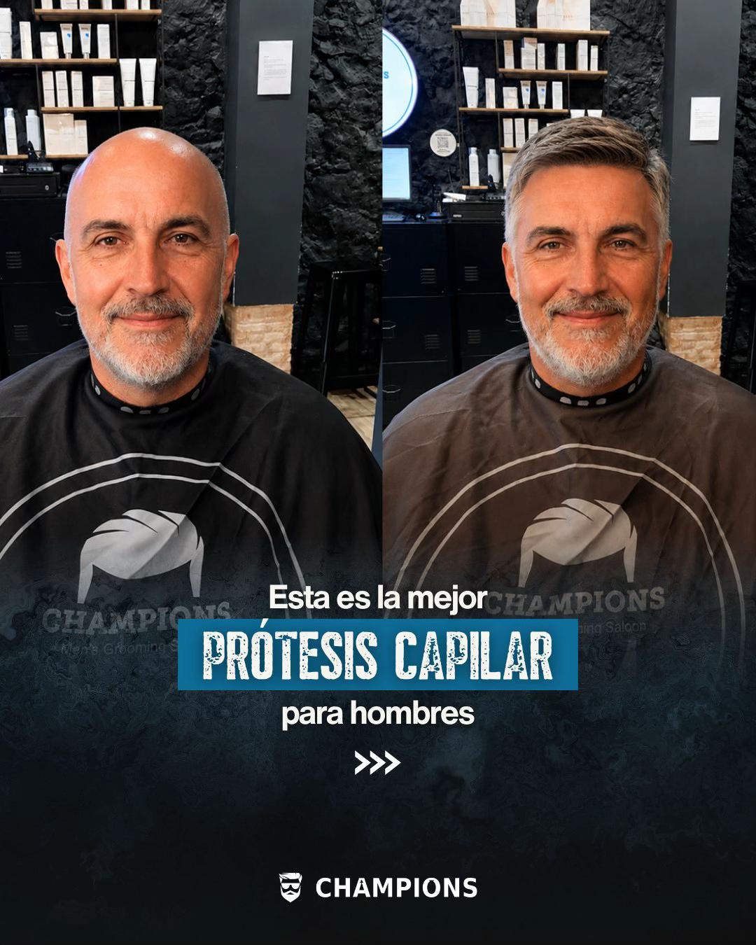 @Champions.men