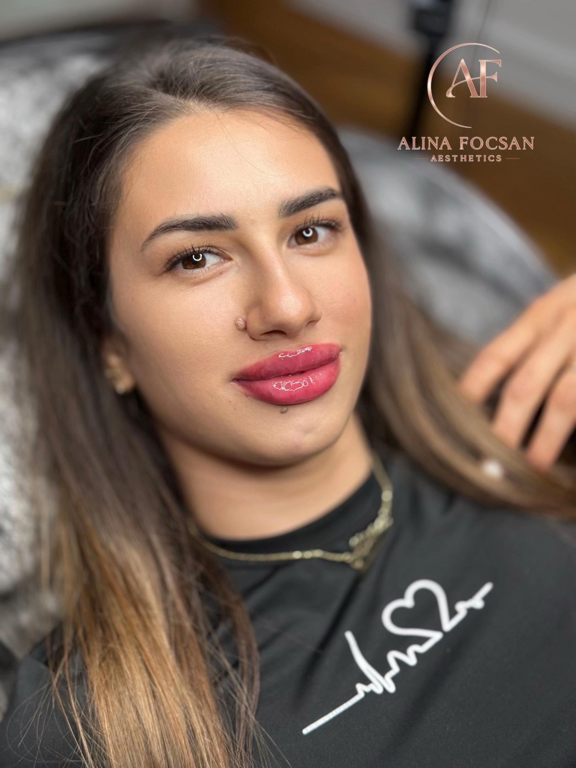 @Alina Focsan