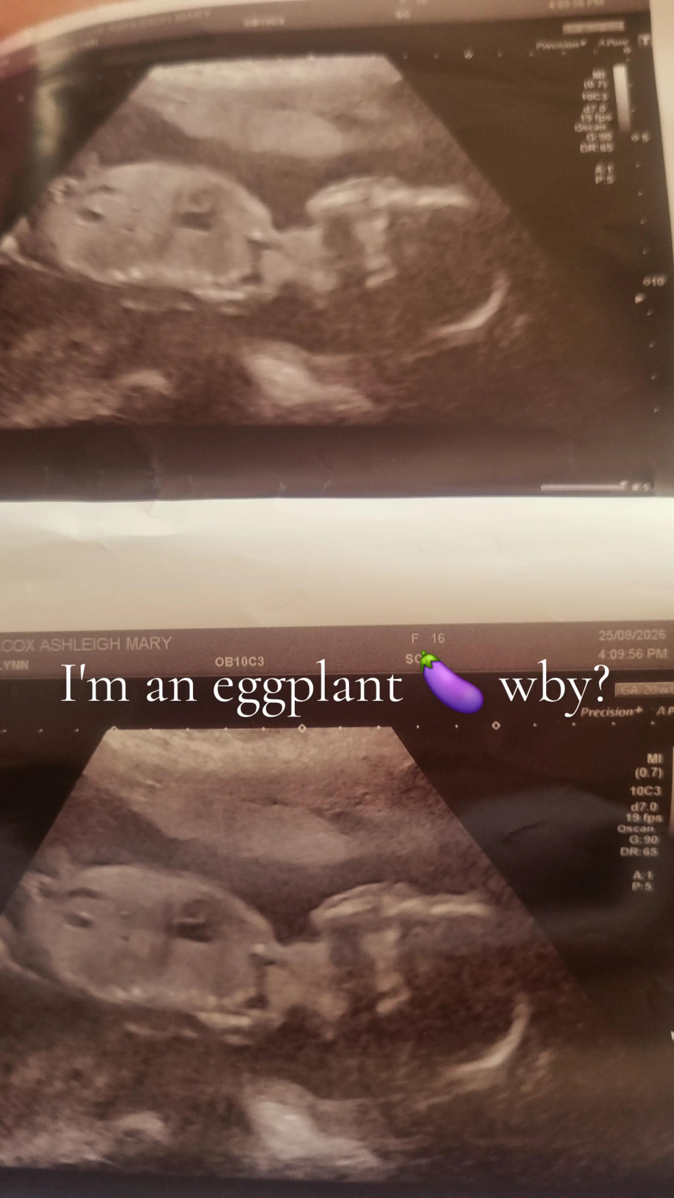 @Ashleigh.teenmama2under2♡