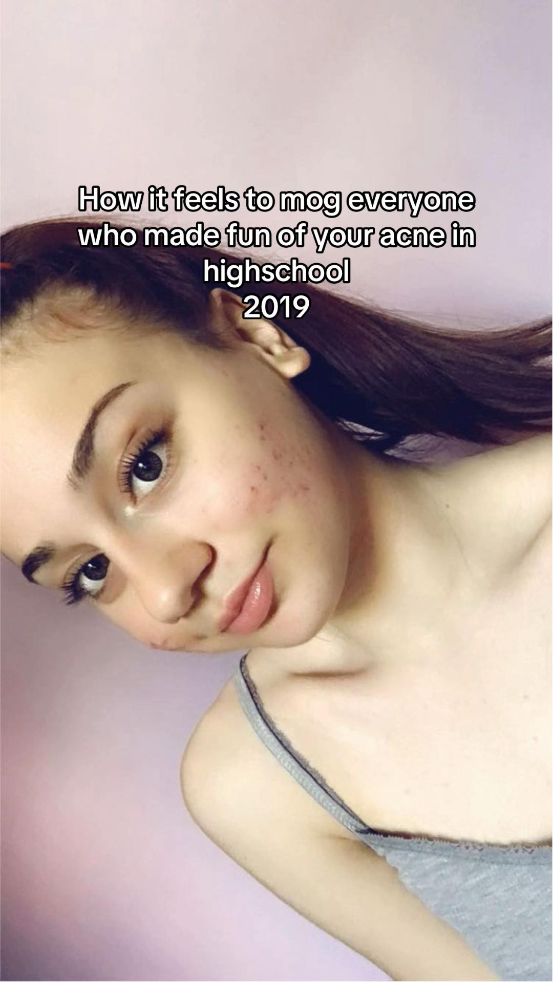 @Beckyy