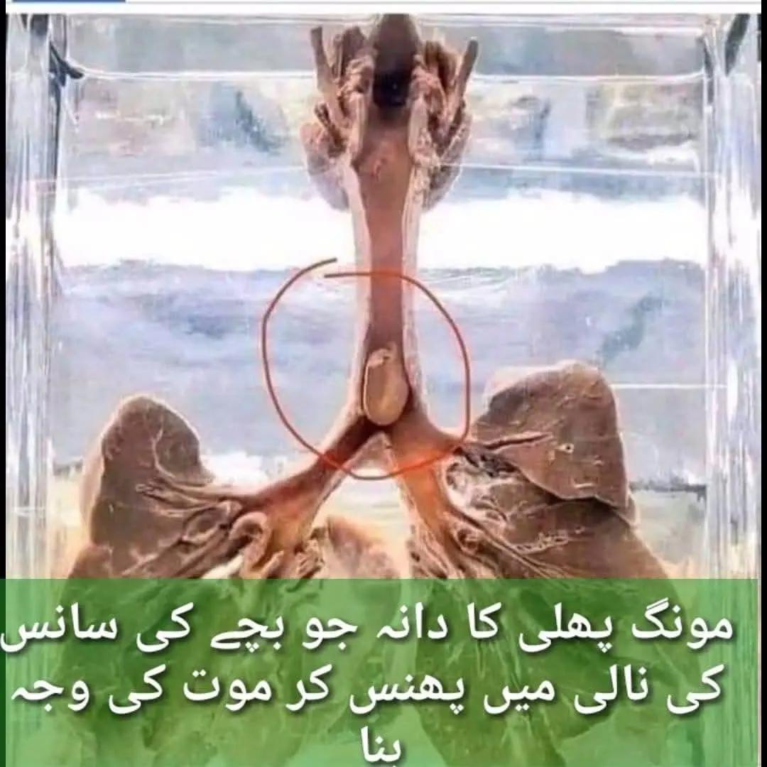 @Dr Arshad Child Neurologist