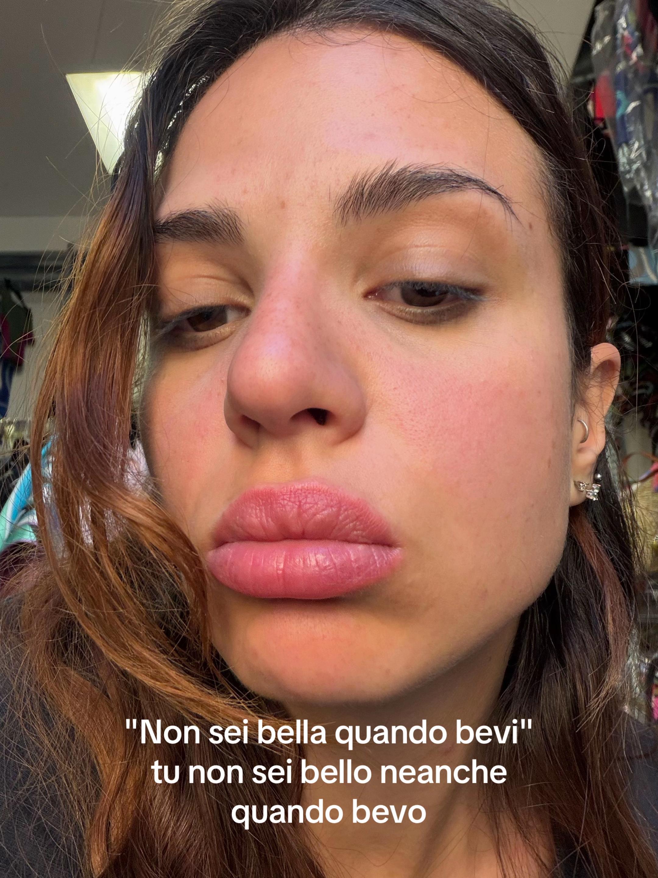 @Mirgiam