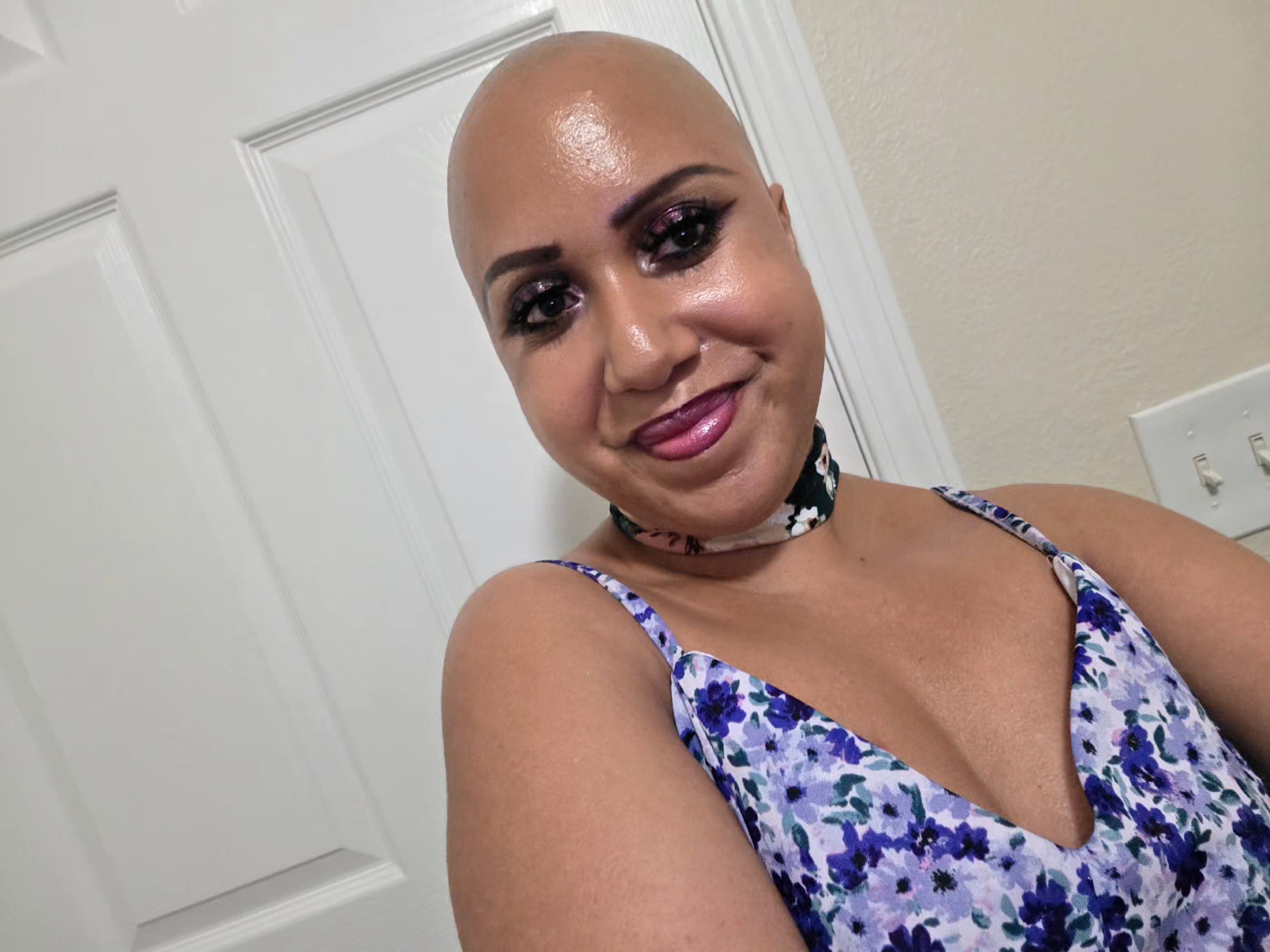 @🫶🏼baldBaddieJasmine👨🏼&zwj;🦲