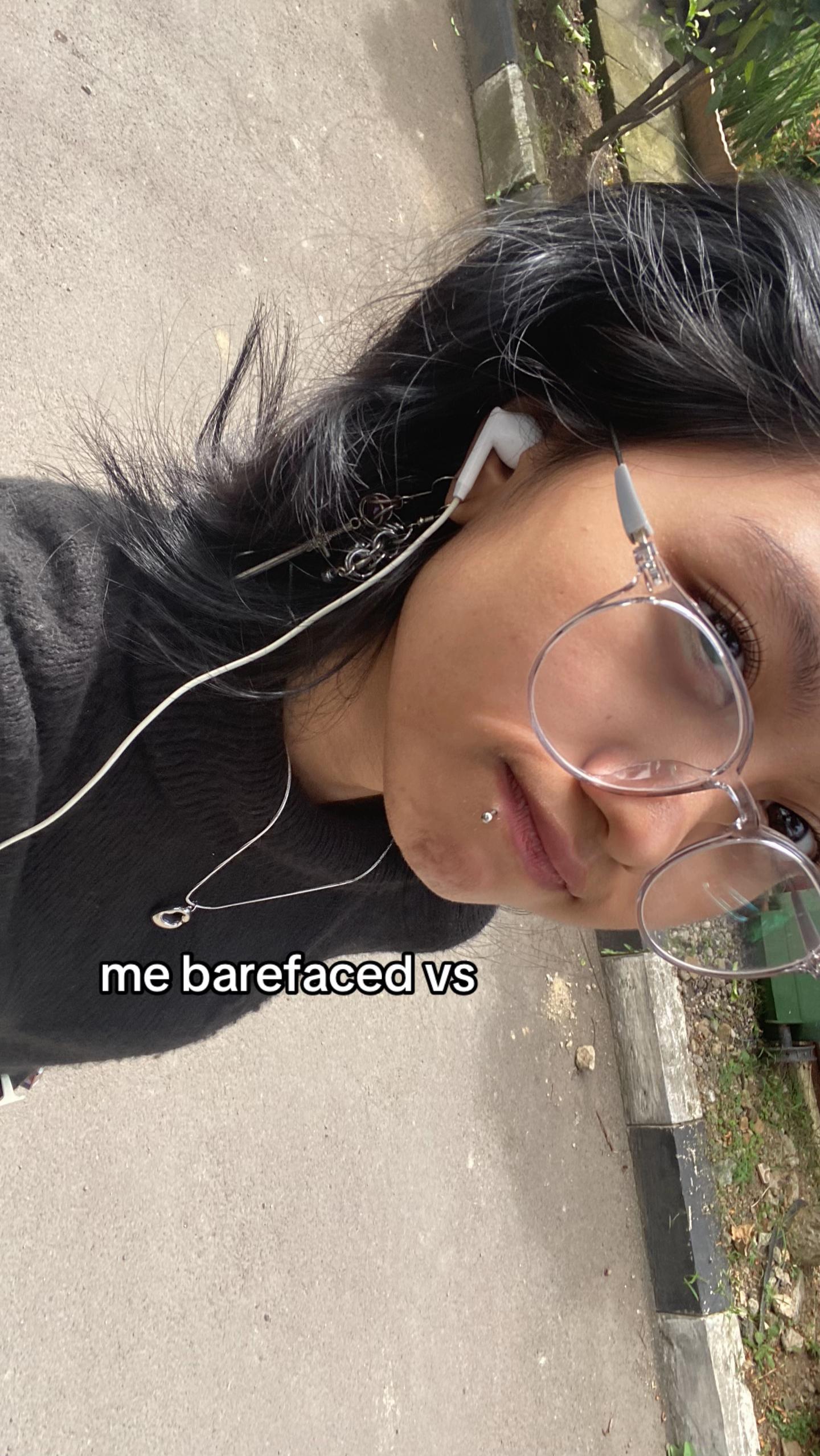 @Dhyla