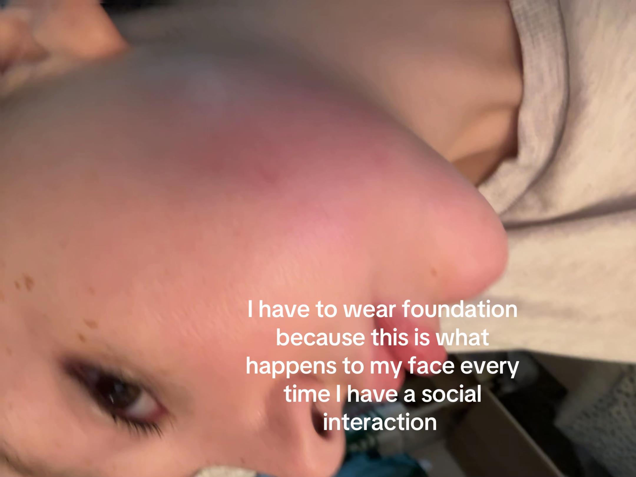 @Anoi