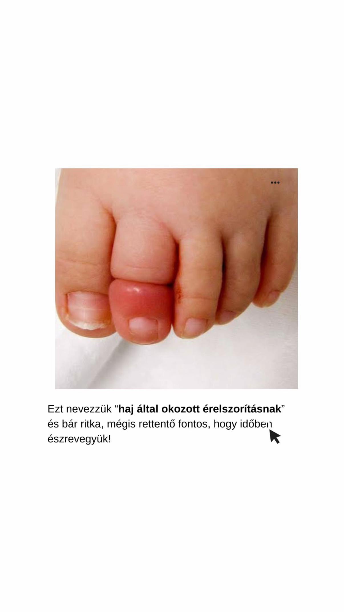 @Eker Timi | mibollesz.hu