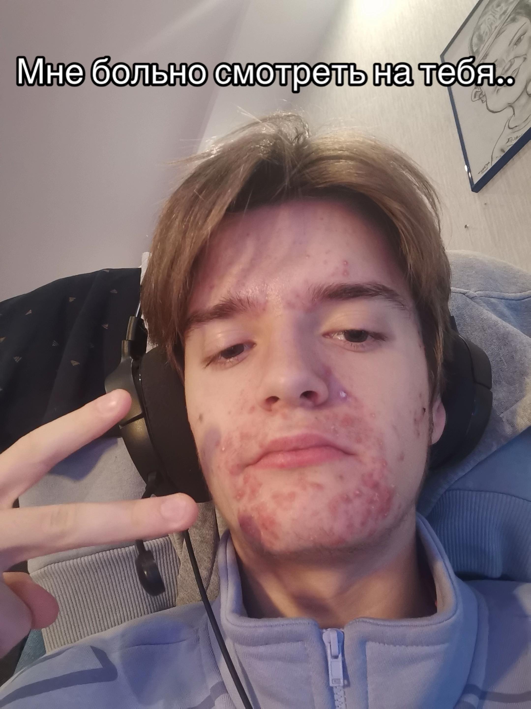 @MaxMrako