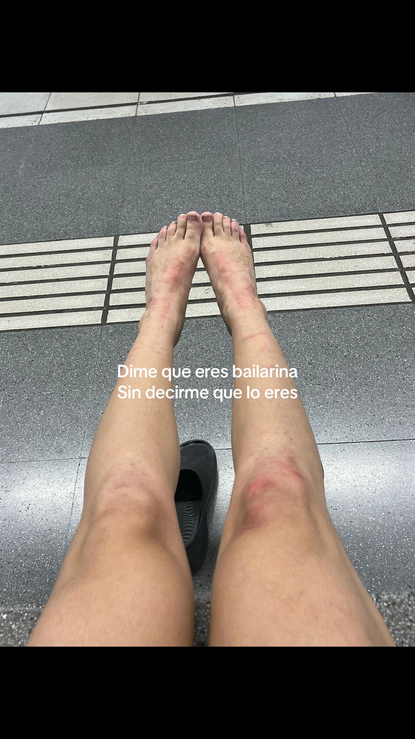 @irina gasch 🩰👯♀️🩵