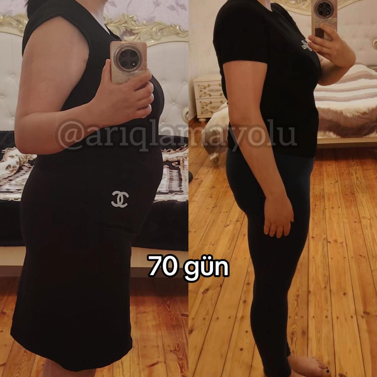 @Nutrisioloq Nilay Camalova 🥑