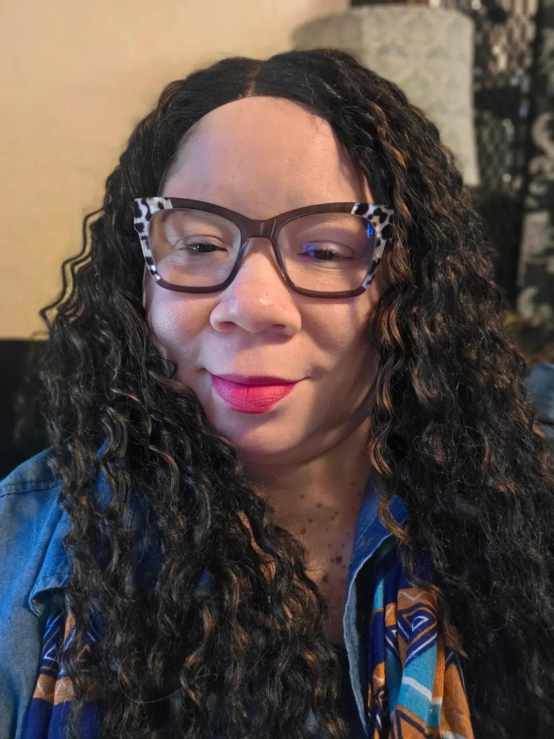 @Miss. PinkY(vitiligo girl)