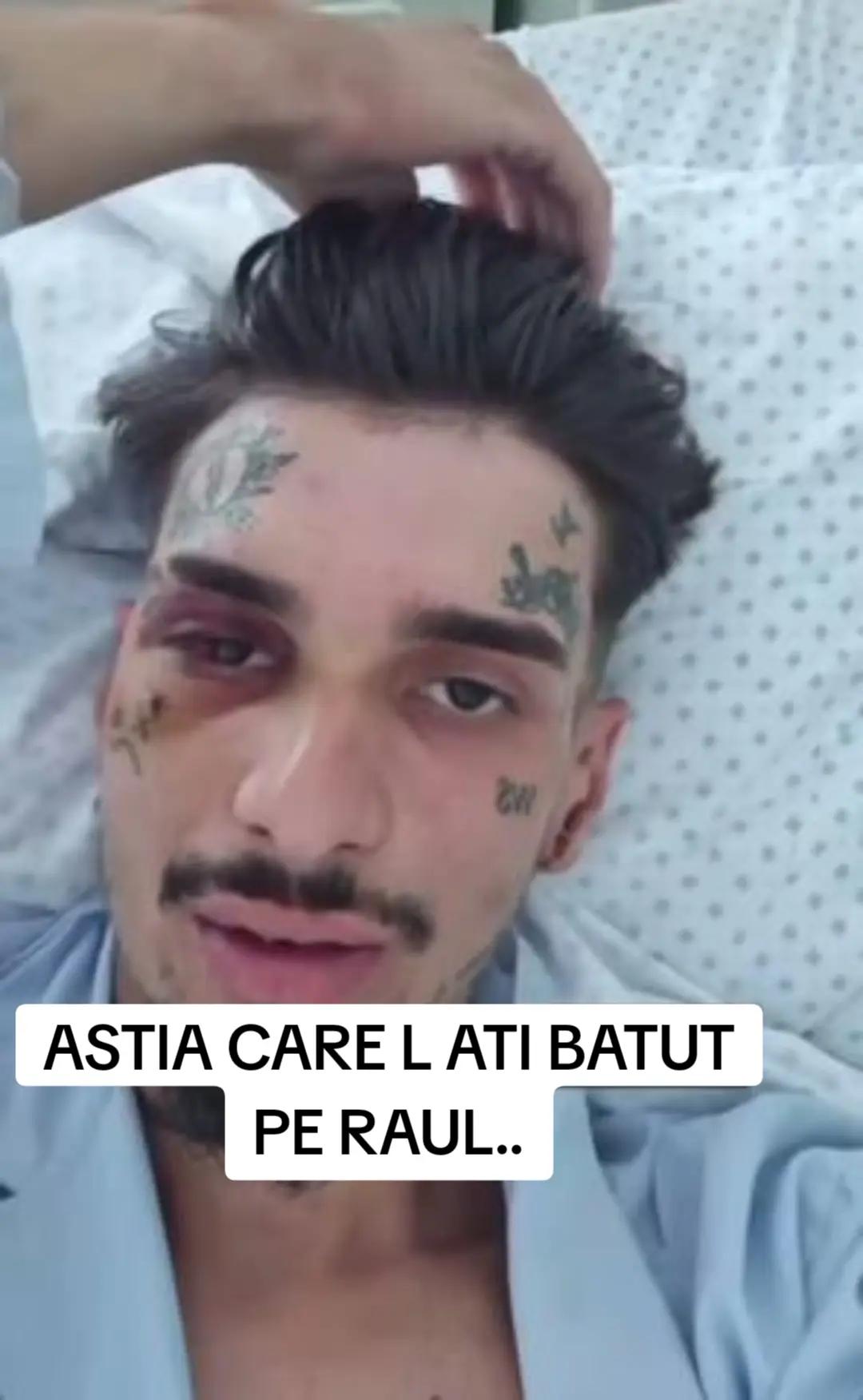 @Renato Lacrimă
