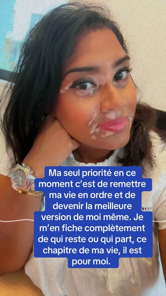 @Mimie | Vitiligo 🤍🌸