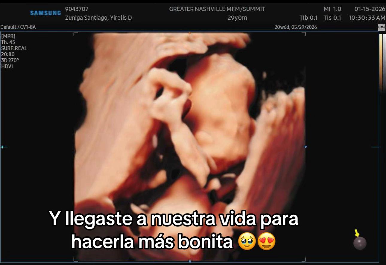 @yirelisz