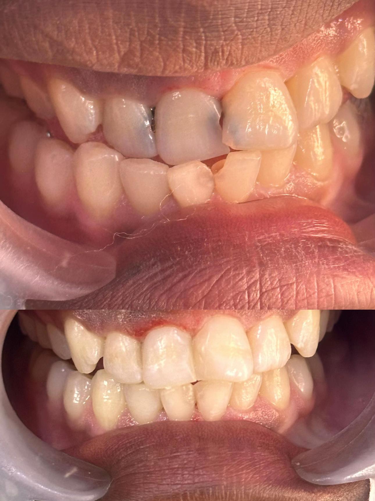 @Dr~MUJUNI 🦷🇺🇬✅