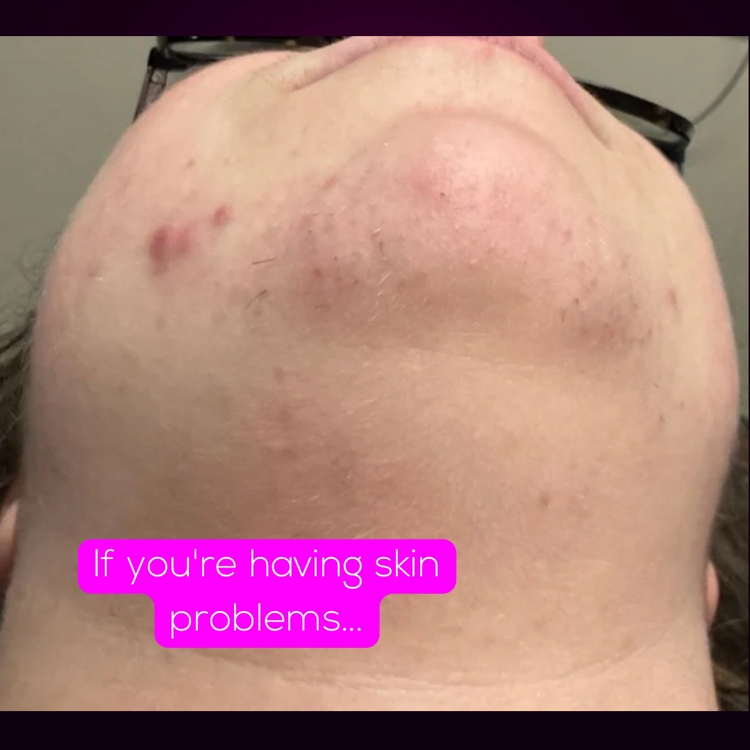 @Neurospice Beauty Electrolysis