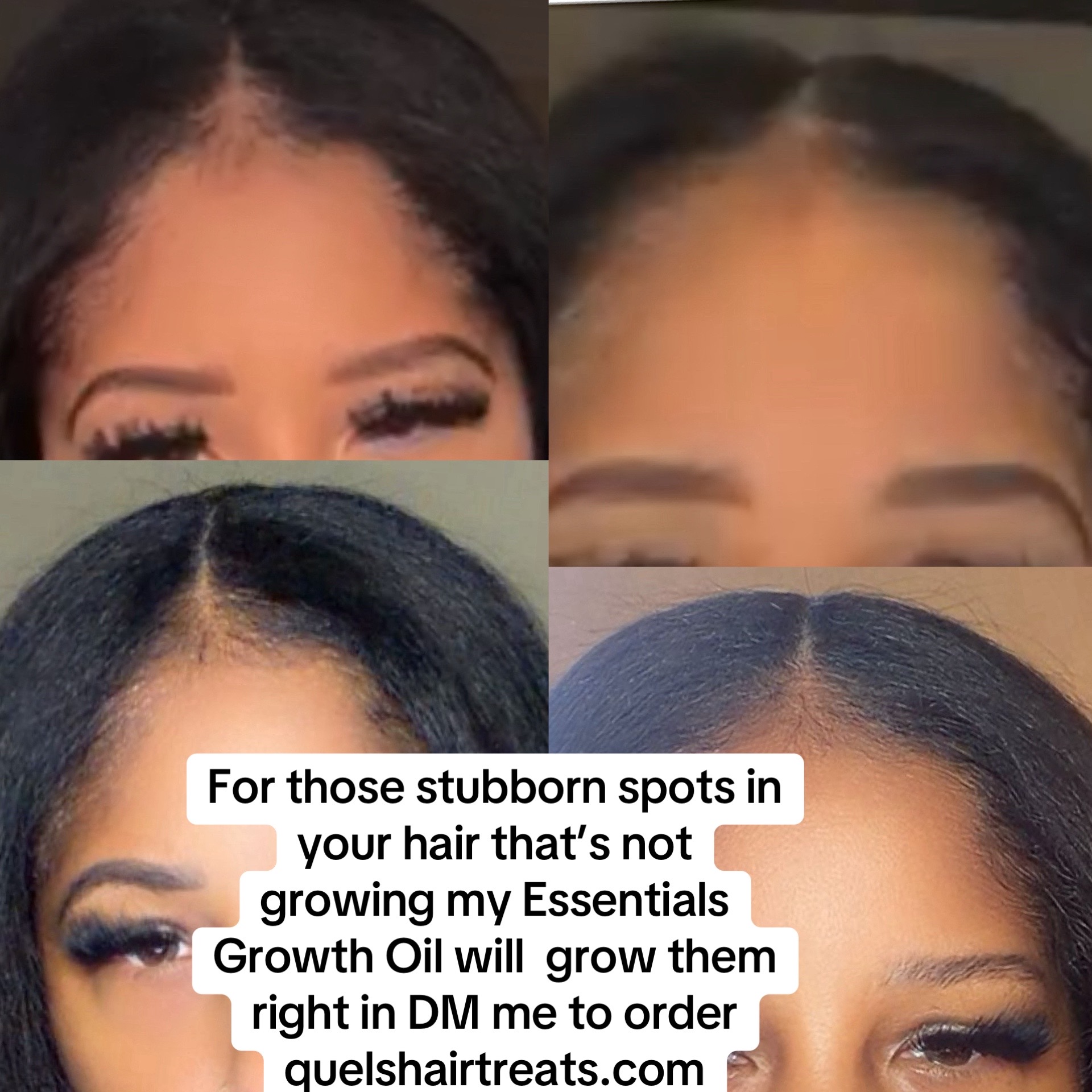 @Quels Hair Treats