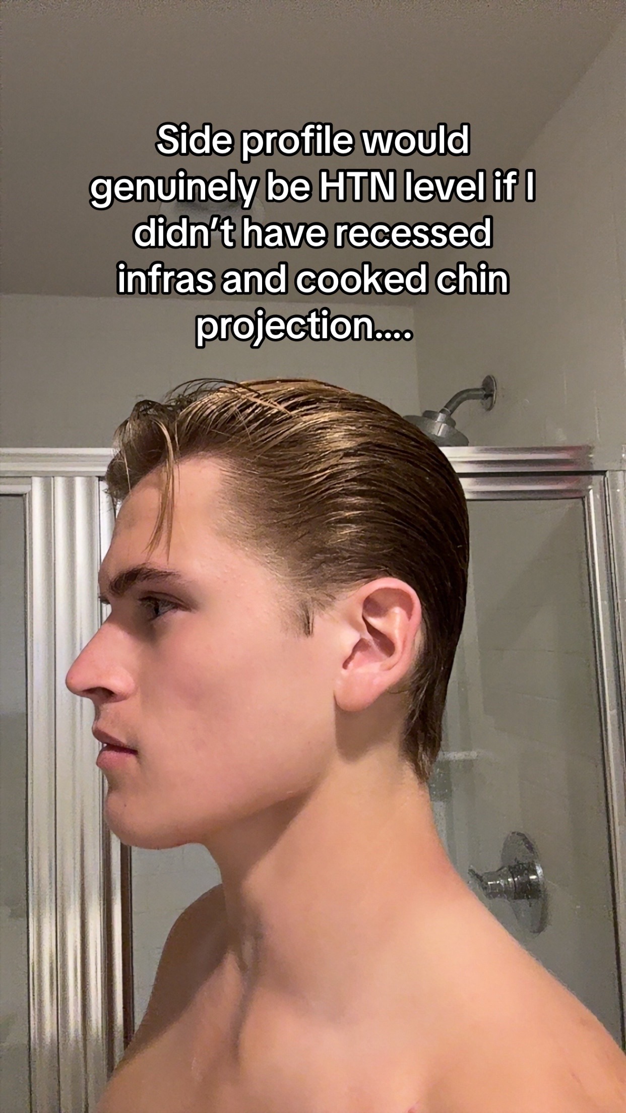 @PG