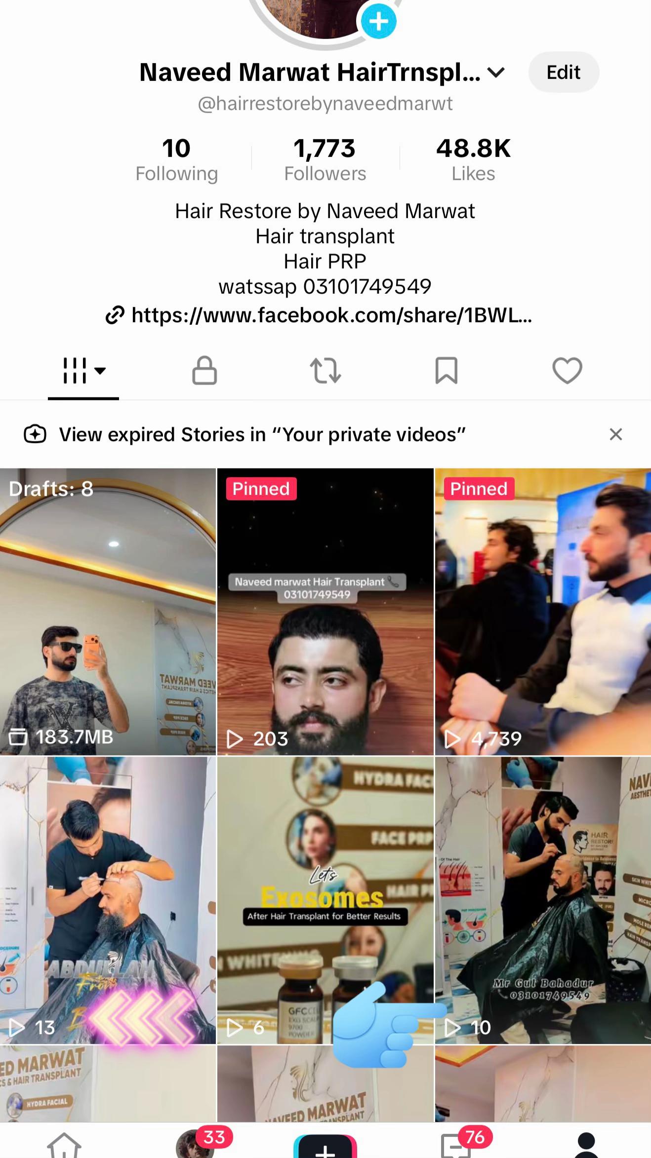@Naveed Marwat HairTrnsplant