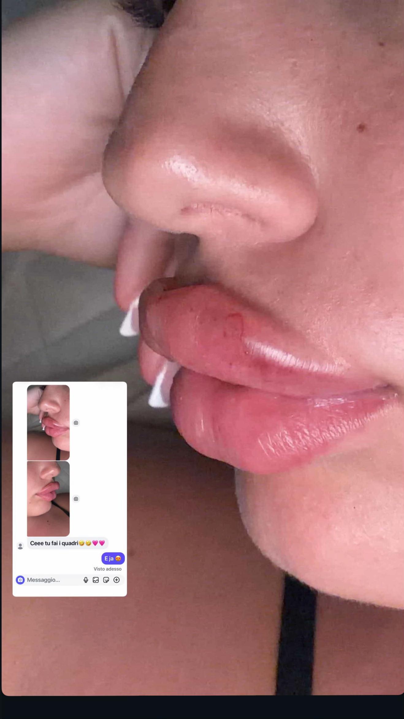 @Rosa.medical.cosmetic💉💕