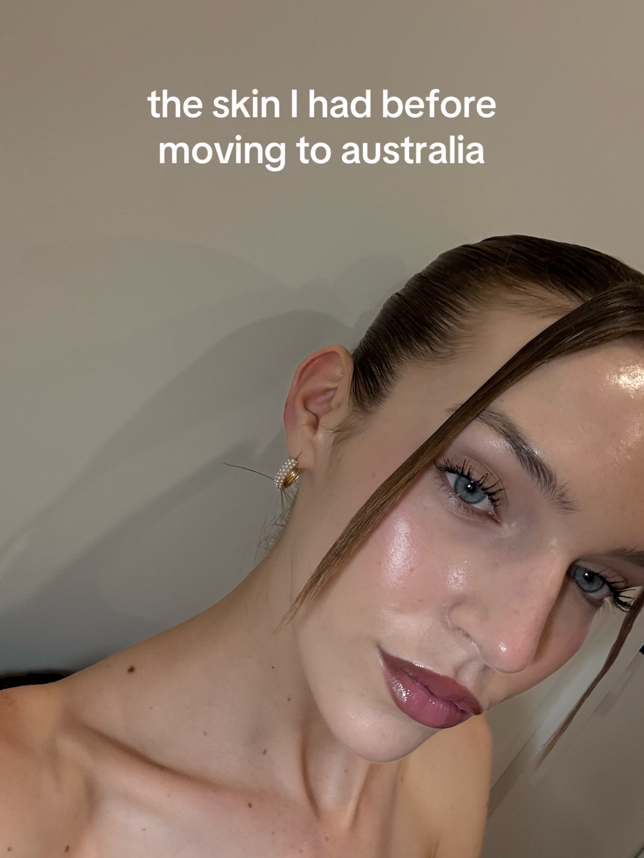 @Zoe
